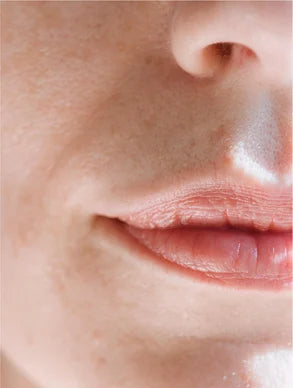 Sensitive Skin Moisturiser